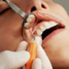 Dentální hygiena: NAPADENT