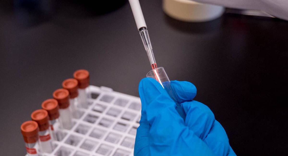 Aktuální informace z krajské hygienické stanice